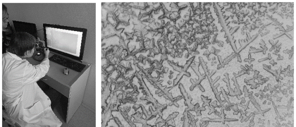 Микрокристаллы крови под микроскопом после обработки химическими реагентами по тесту Тейхмана