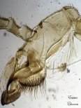 Членистая конечность насекомого, микропрепарат сделан при помощи
 цифрового микроскопа, автор Евсеева Элеонора