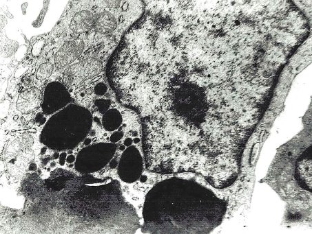 Ретикулярная клетка синуса в состоянии фагоцитоза. Электронограмма. х 15000.