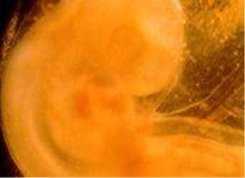 Главный конец зародыша 3–х недель внутриутробного развития (вид сбоку). Микрофотография. Увеличение х 140.