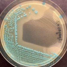 Рост Listeria monocytogenes на среде Оттавиани и Агости (ALOA)