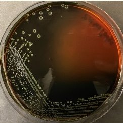 Рост Listeria monocytogenes на среде PALCAM
