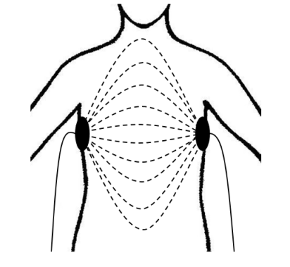 Распределение зондирующего электрического тока в тканях грудной клетки