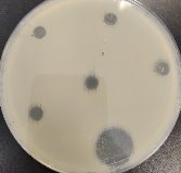 Зоны лизиса бактериальной культуры — результат активности L-PRP