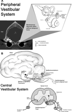 Схематическое изображение нейроанатомии периферического (А) и центрального (В) компонентов вестибулярной системы. (Иллюстрация Терри Лоуренс, региональный ветеринарный колледж Виргинии-Мэриленда, кафедра биомедицинской иллюстрации.)