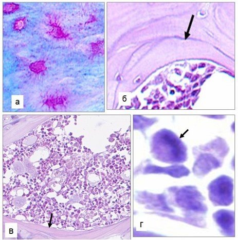Структурные изменения в головке бедренной кости через 8 недель моделирования остеопороза и терапии ресвератролом: а — интактная структура остеоцитов, б –новообразованные костные пластины с цементирующими линиями (стрелка), в — костномозговые пространства со снижением количества жировых клеток, г — митоз(метафаза) в области эндостальной концентрации кость-выстилающих клеток. Окр. гематоксилином и эозином (б,в,г), по Маллори(а). Ув х400(а,г), б,в –сканированные препараты