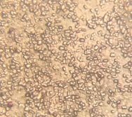 Колонии бактерий закрытого грунта, глубина 20 см. (1- светлая колония, 2- темная колония) (Ул. Южная).
