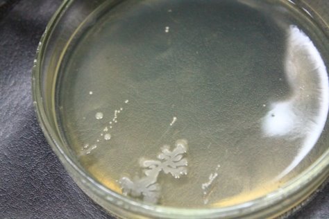 Выросшие колонии микроорганизмов