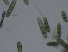 Конидии патогена Pyrenophora teres (оригинал, 2020 г.)