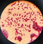 Микрофотография азотфиксирующих бактерий Azotobacter chroococcum