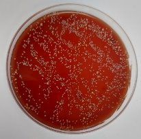 Количество колоний бактерий на питательных средах до гигиенической обработки рук