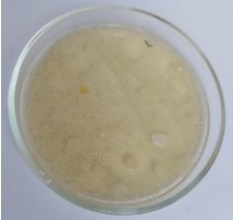 Количество колоний бактерий на питательных средах до гигиенической обработки рук