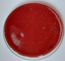 Количество колоний бактерий на питательных средах после гигиенической обработки рук салфетками