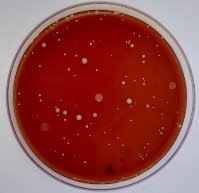 Количество колоний бактерий на питательных средах после гигиенической обработки рук спреем