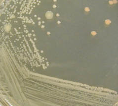 Рост культуры Staphylococcus aureus (золотистого стафилококка) в среде желточно-солевого агара