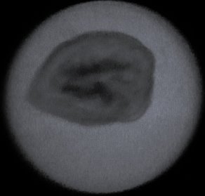 Ренгенограммы грецкого ореха с ядром (слева) и без ядра (справа)